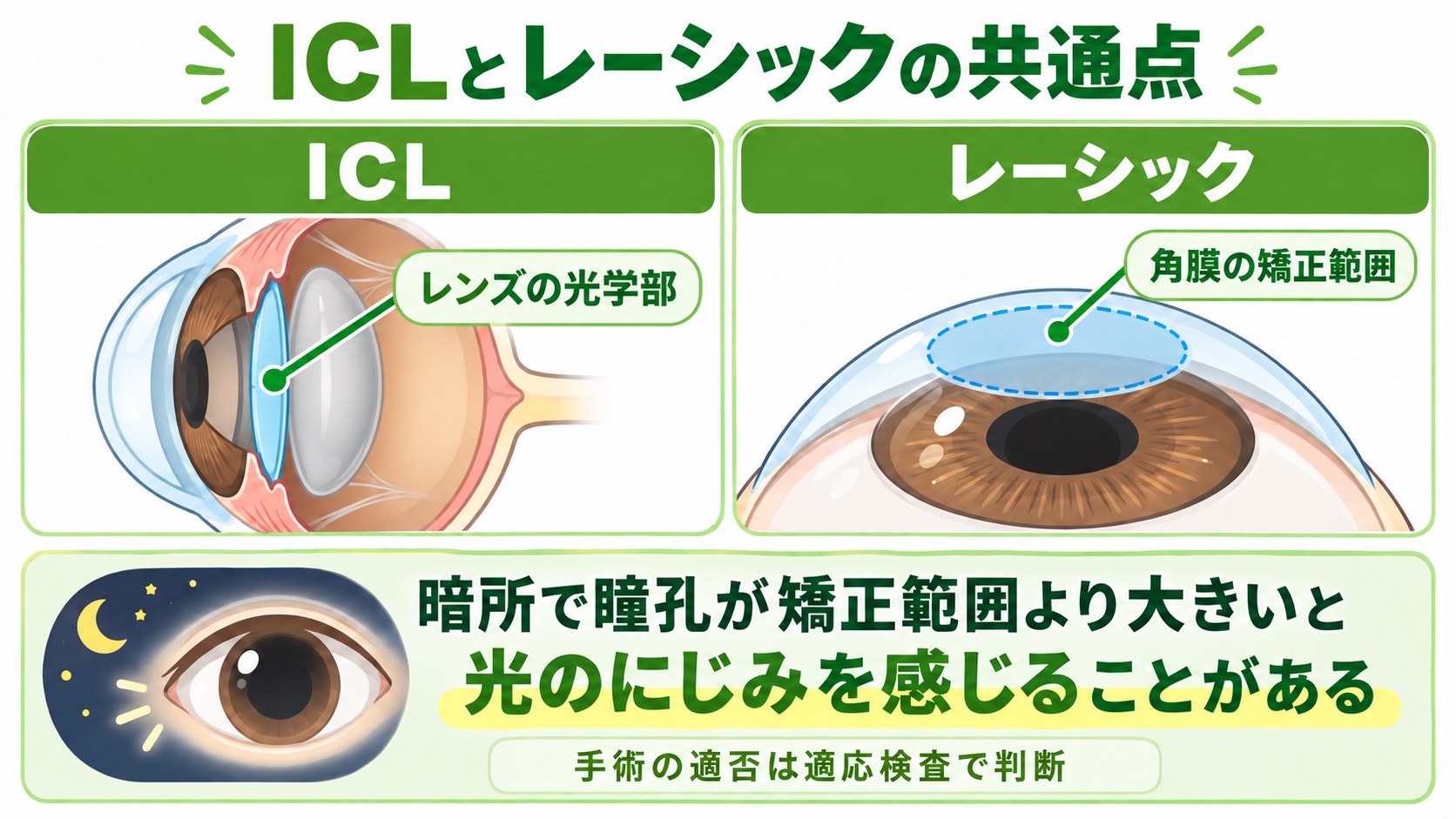 ICLとレーシックの共通点：レンズの光学部や角膜の矯正範囲より暗所の瞳孔が大きいと光のにじみを感じることがある。手術の適否は適応検査で判断